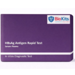 Biokits HBsAg Rapid Test - 30 Test Pack